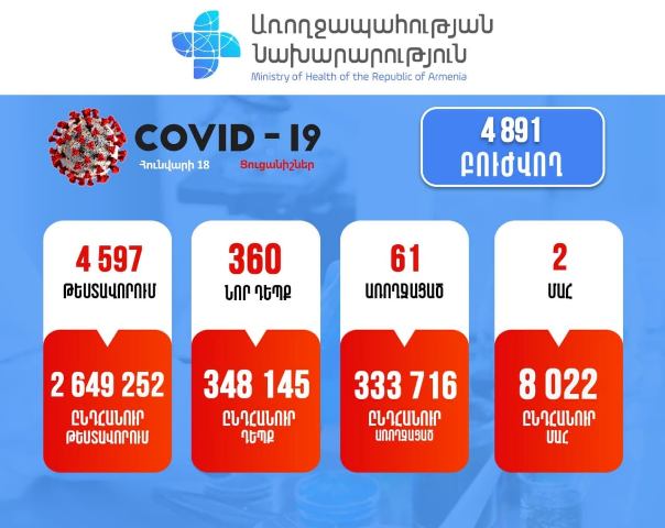 Հաստատվել է կորոնավիրուսային հիվանդության 360 նոր դեպք, մահվան 2 դեպք է արձանագրվել